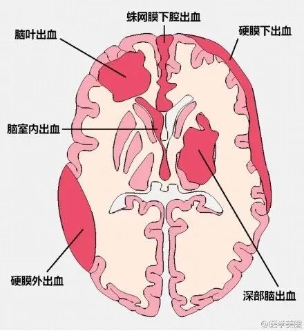 眼组词四个字：大脑奥秘揭秘